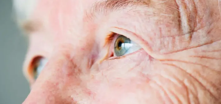 Olhos de uma pessoa idosa